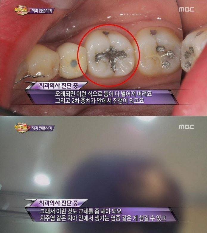 치과 치료의 진실 | 인스티즈