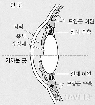 왜 나이가 많아지면 원시가 심해지는가? | 인스티즈