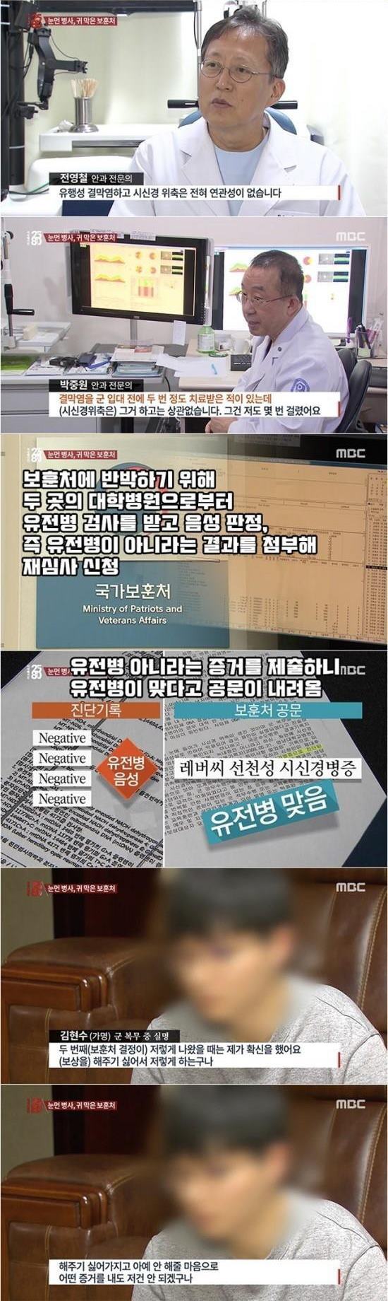 군복무중 실명 | 인스티즈