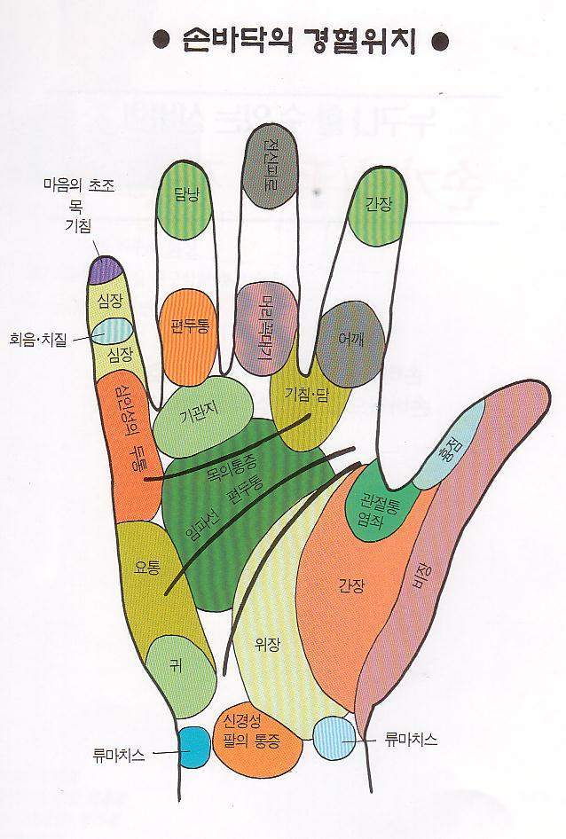 뜸 이미지